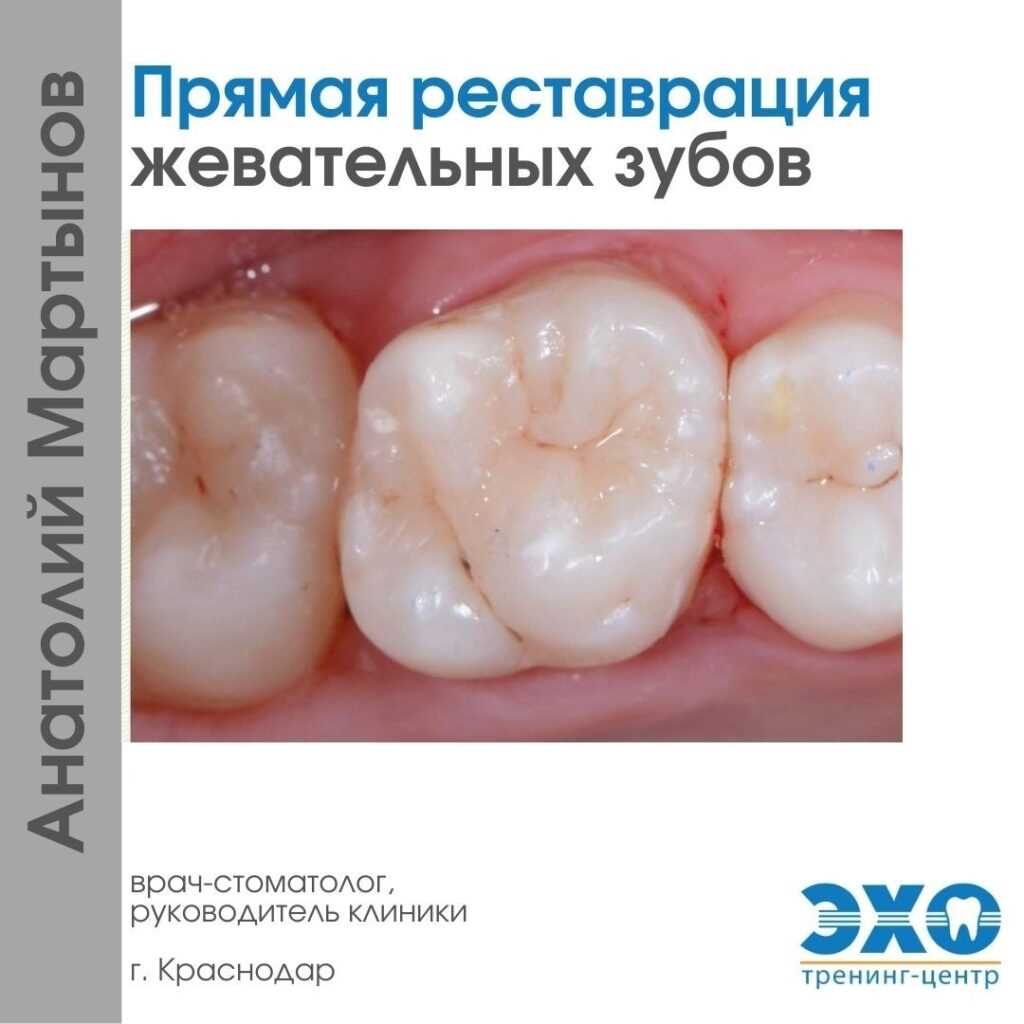 Какие существуют показания к наращиванию зуба?