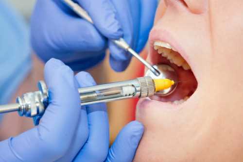 Рекомендации для использования анестезии в стоматологии