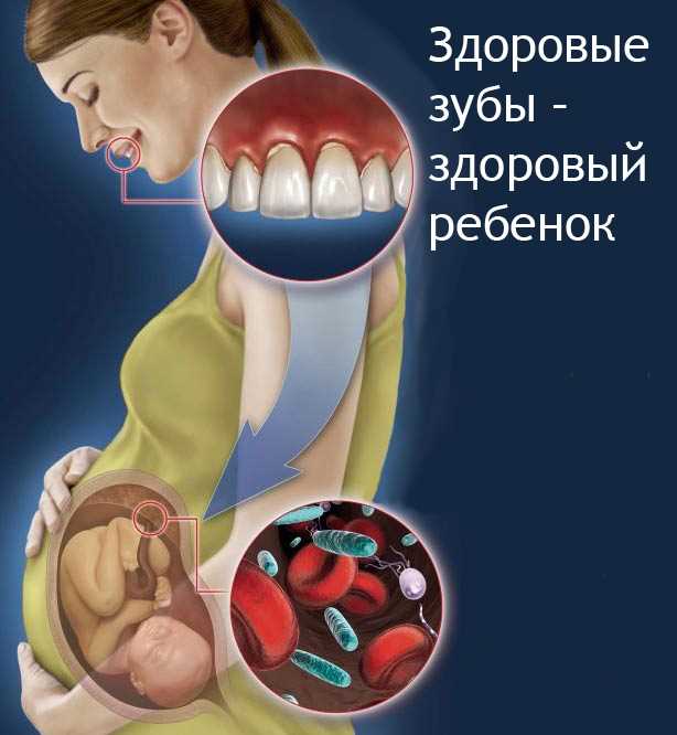 Особенности лечения зубов на разных сроках