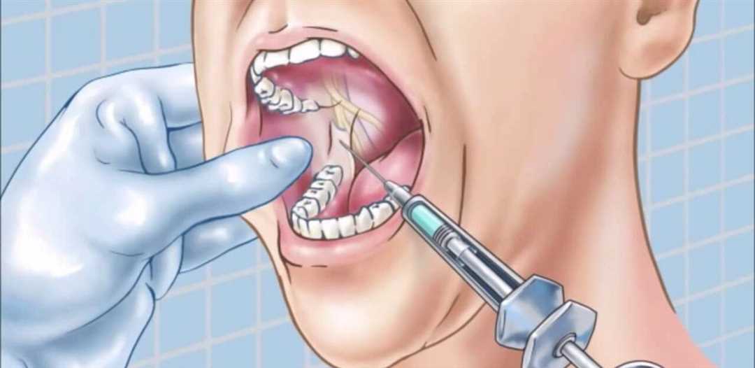Противопоказания к лечению зубов