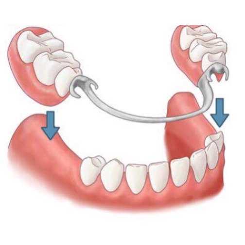 Березовский протезирование зубов