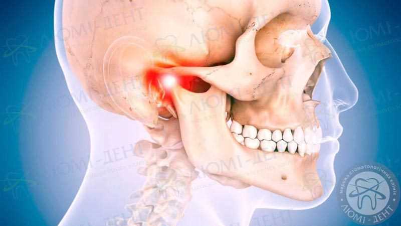Осложнения после лечения зубов