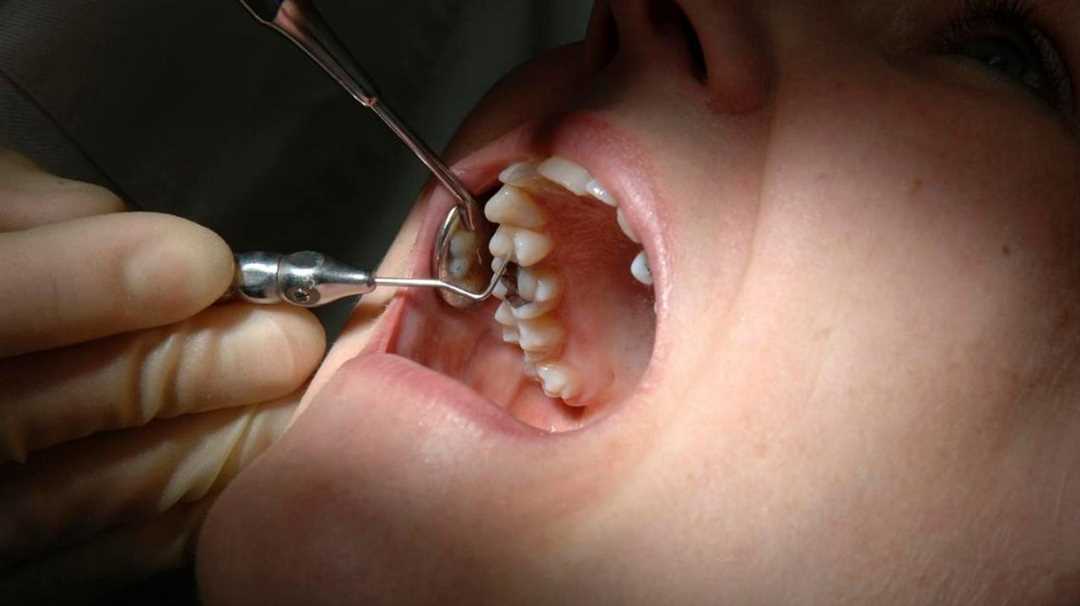 Зуб болит спустя несколько дней, недель, месяцев после процедуры
