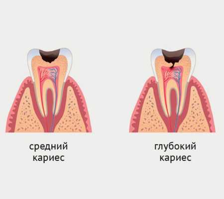 Почему болят молочные зубки