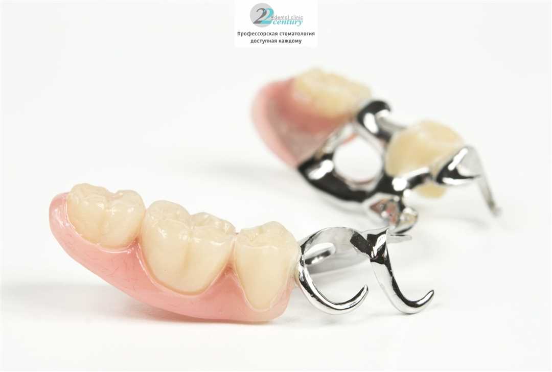 Абсолютная гарантия качества — бугельное протезирование зубов — надежный способ вернуть радость улыбки!