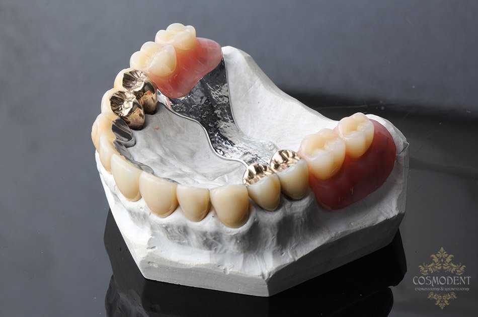 Преимущества лечения в стоматологии ROOTT
