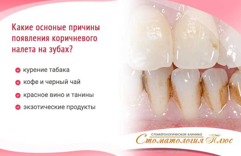 Причины появления налёта на зубах