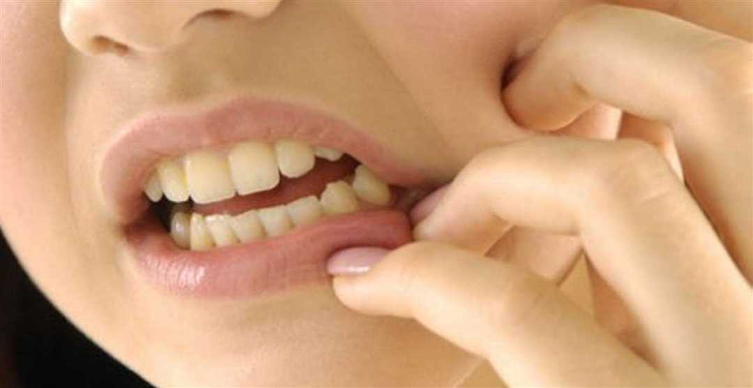 Почему после удаления зуба может появиться зуд и как с этим справиться