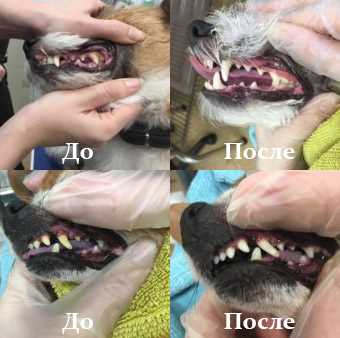 Чистка зубов без анестезии