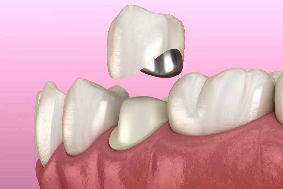 Причины дефектов зубных рядов