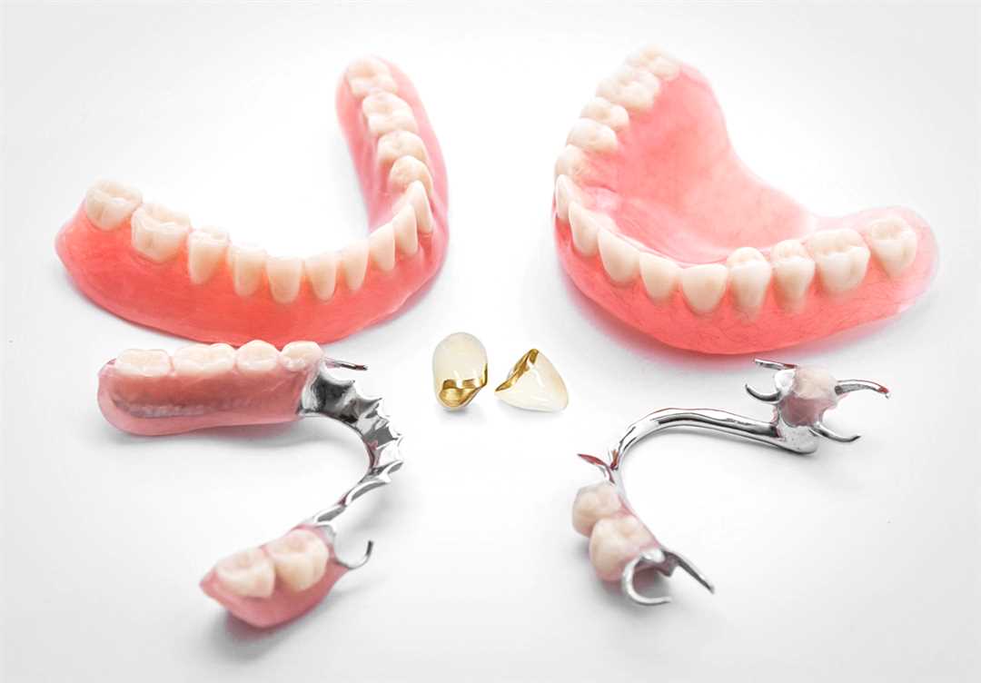 Дефекты протезирования зубов