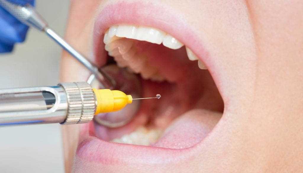 Лучшая анестезия для жевательных зубов