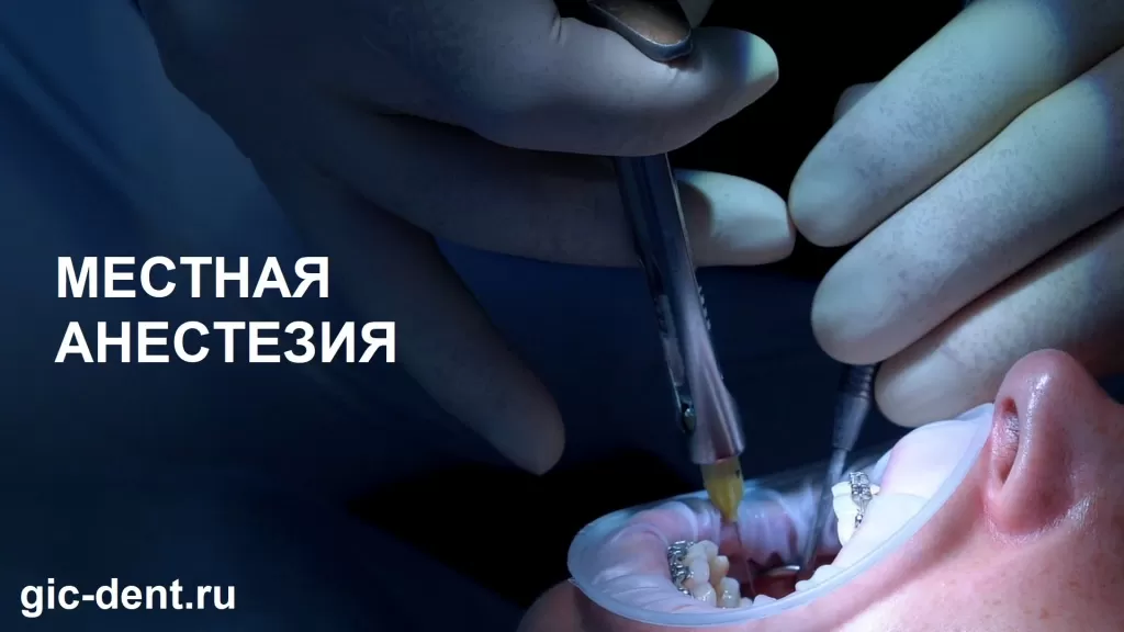Лучшая анестезия для передних зубов