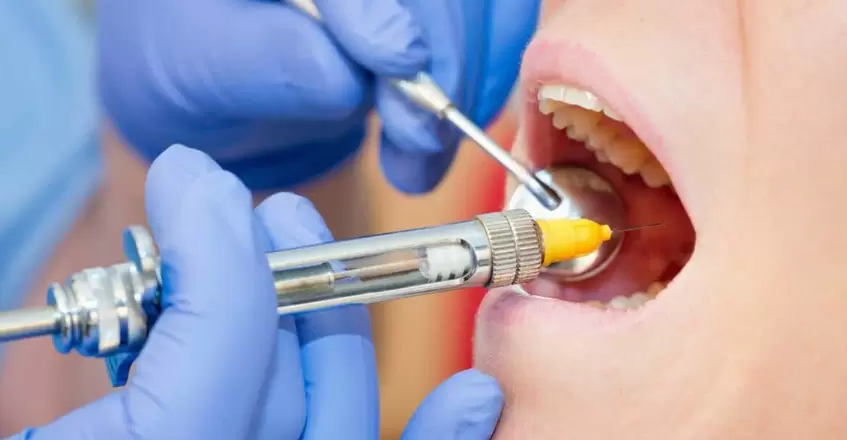 Для какого зуба какая анестезия
