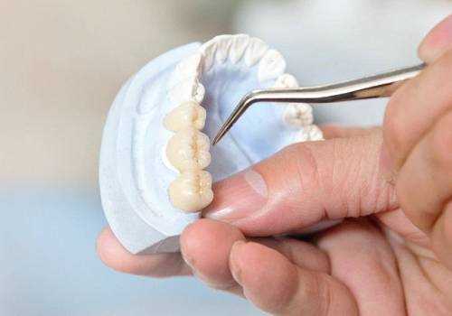 Этапность протезирования зубов