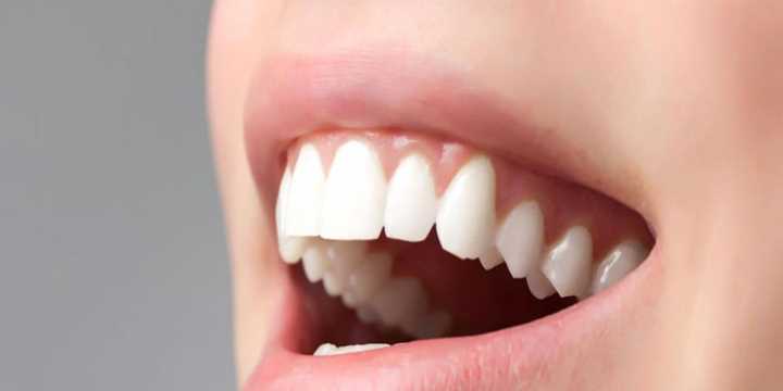 Зубы зоны улыбки – выбираем коронки