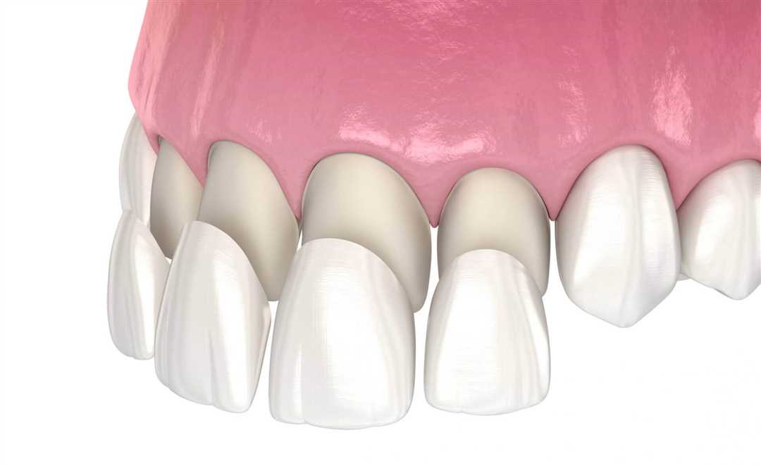 Возможности стоматологических процедур