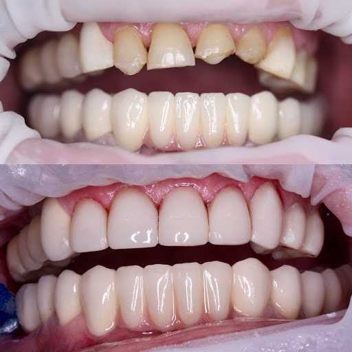 Функциональное и эстетическое восстановление зубов