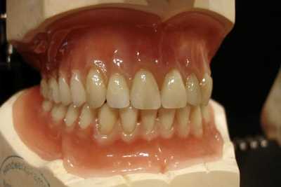 Гарнитура зубов для протезирования