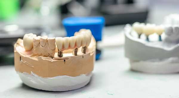 Преображение улыбки — всё, что вам нужно знать о протезировании зубов