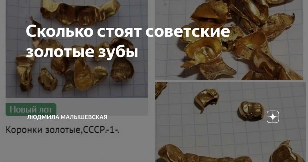 Видео о скупке золотых коронок в СССР