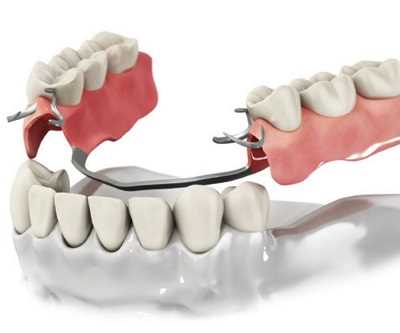 Киселевск — инновационное и качественное протезирование зубов для здоровой и красивой улыбки