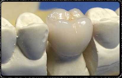 Композитные зубные коронки