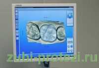 Технология CADCAM или компьютерное протезирование новый виток в истории стоматологии