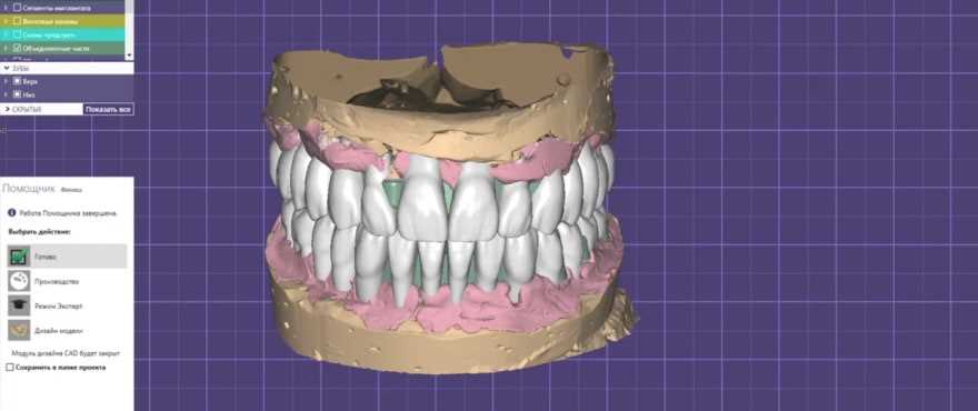 Компьютерное протезирование зубов