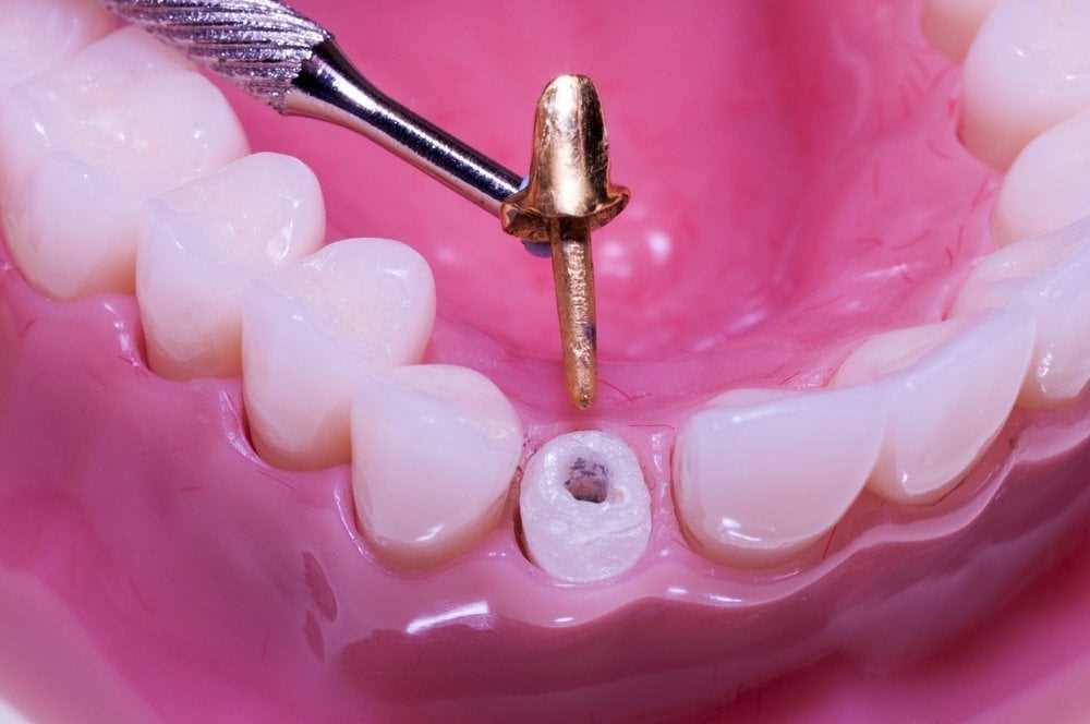 Структура и функции зубной коронки