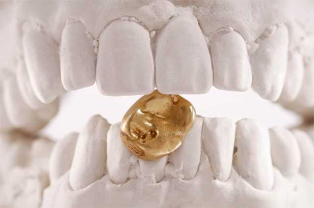 Какие виды стоматологического золота нам можно продать?