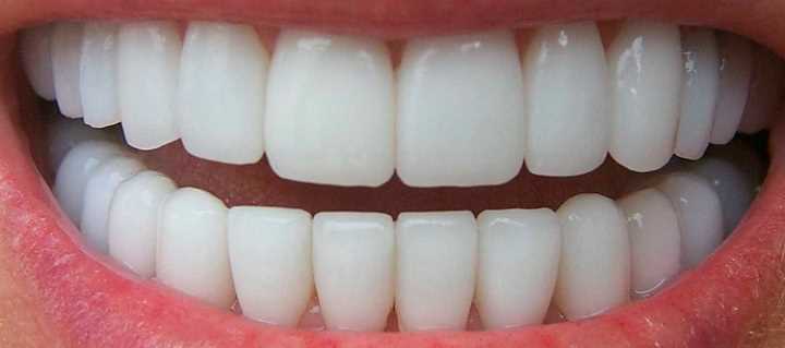 Красивые зубы протезирование