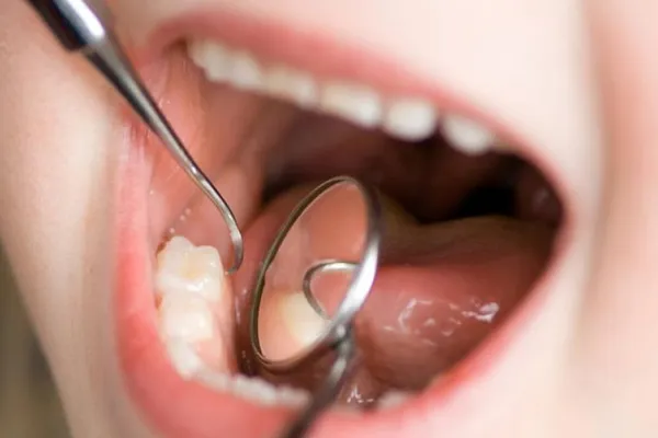 3. Очаги инфекции в полости рта
