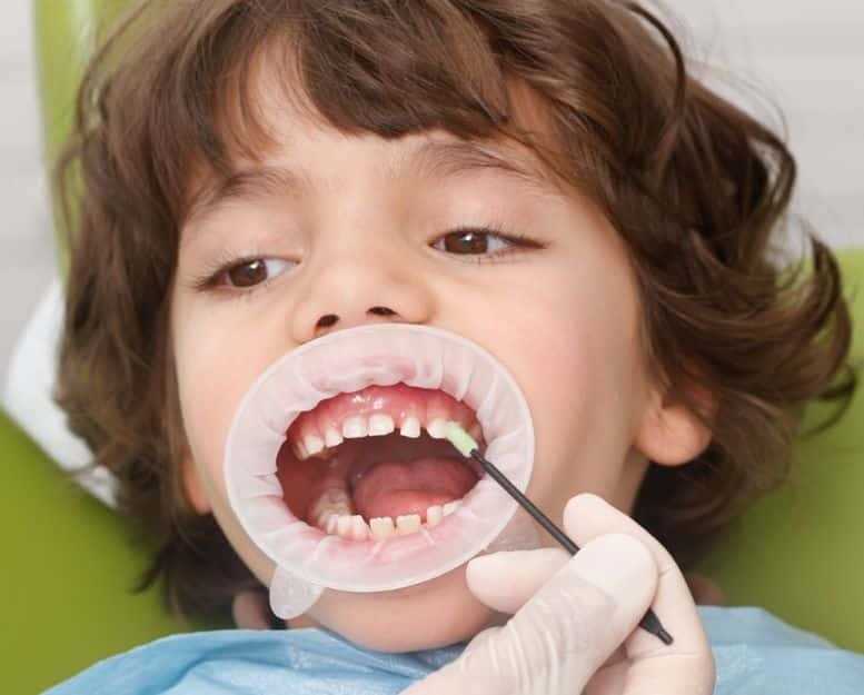 Лечение десен у детей — эффективные методы и советы для здоровья детской полости рта