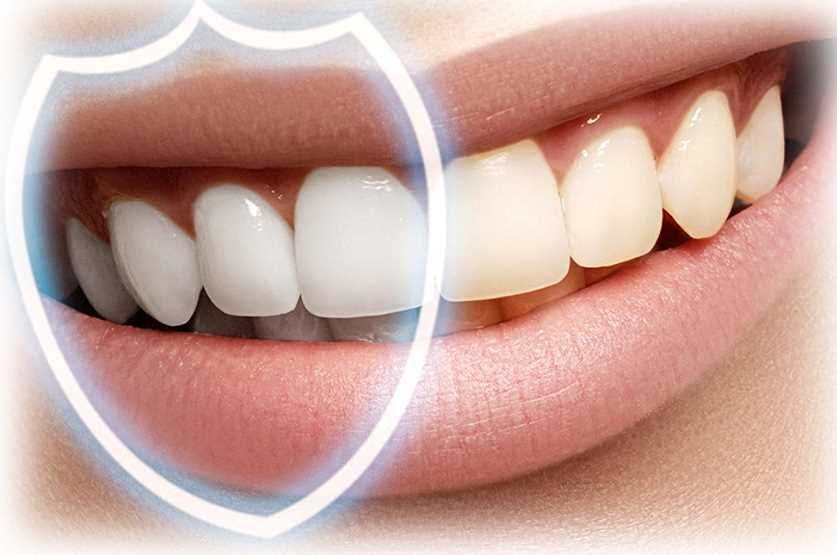 Использование фторирования в лечении кариеса для укрепления зубной эмали и предотвращения развития заболевания