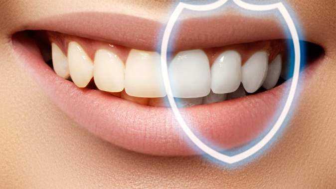 Что такое реминерализация зубов?