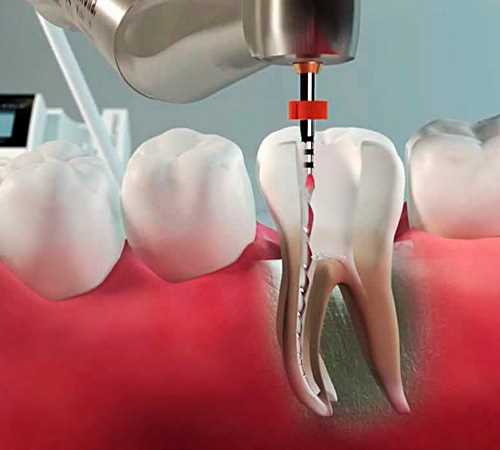 Цены на услуги терапевтической стоматологии