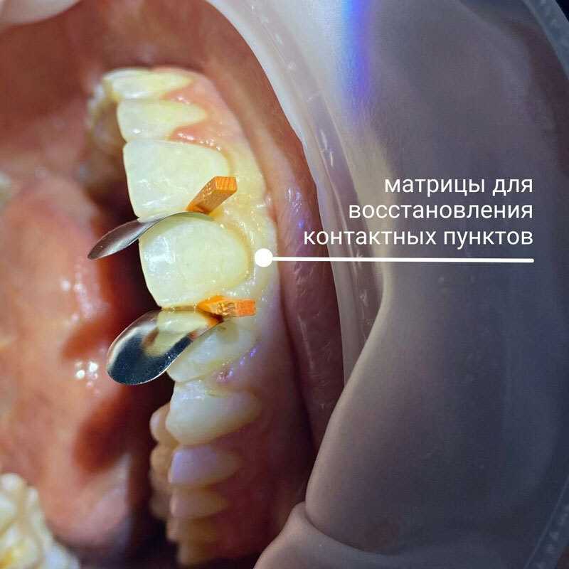 Чек-лист перед лечением у ортодонта