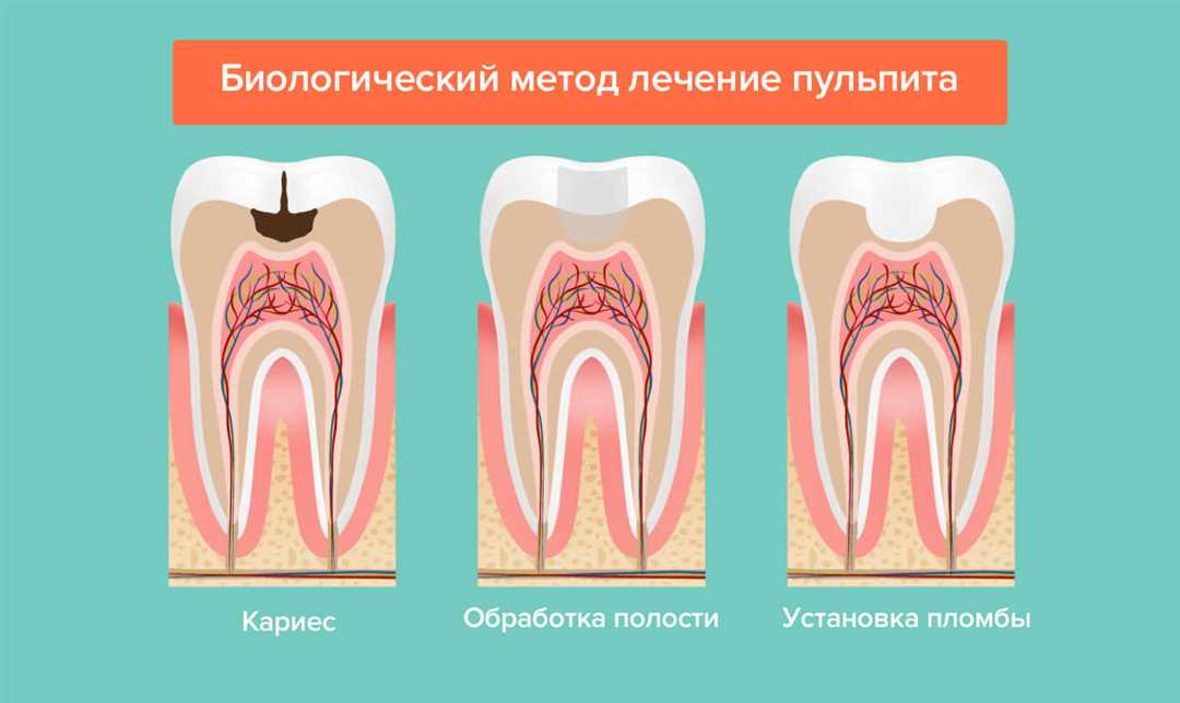 Цены на лечение зубов