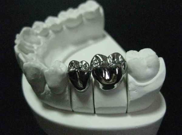 Цельнолитые зубные коронки
