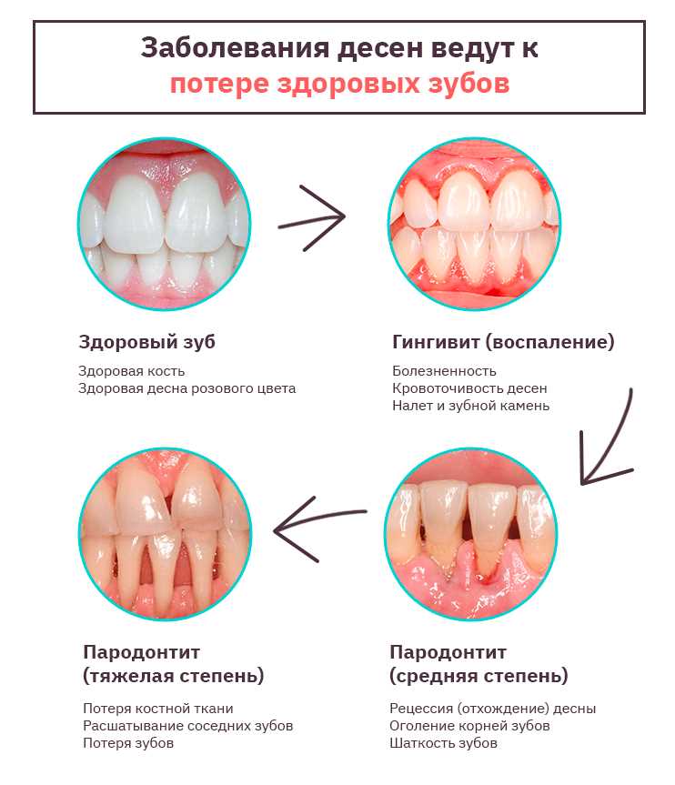 Как использовать мантру от зубной боли: