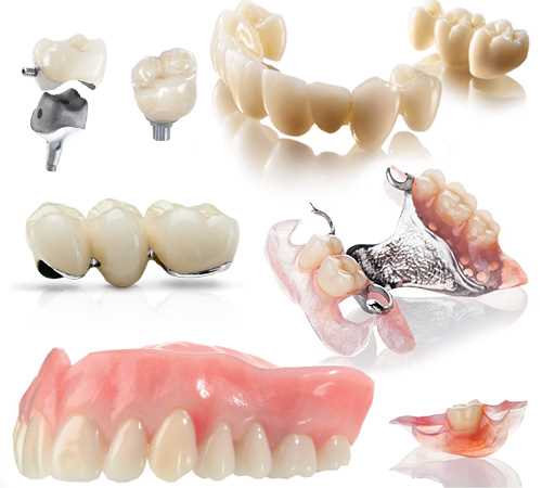 Этапы установки искусственных зубов и челюстей