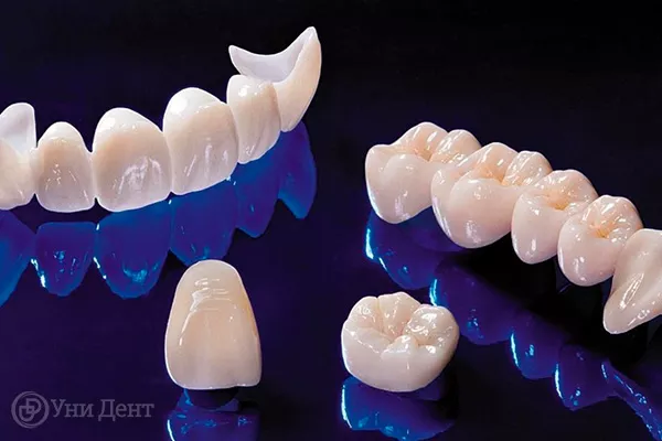 Между коронками зубная нить обходит стороной — почему это важно и как сохранить здоровье зубов?