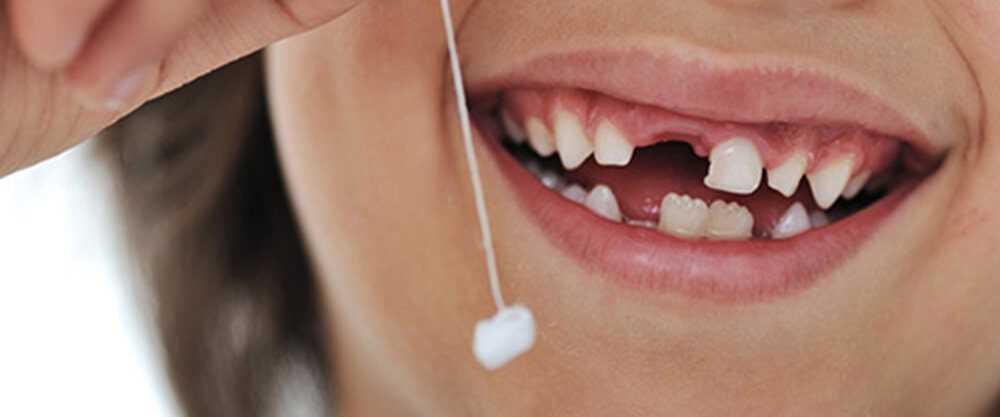 Удаляющие молочные зубы у детей без использования анестезии — обновленные методы и преимущества