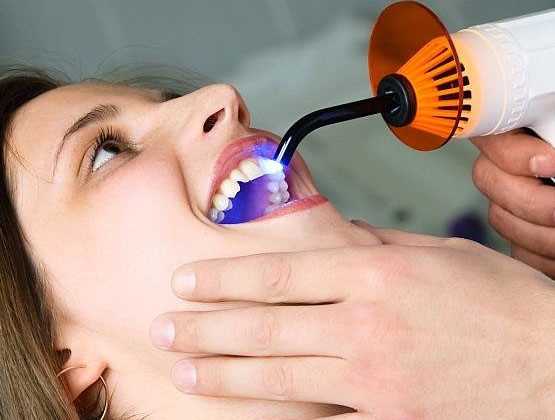 Чего нельзя делать до приема стоматолога?