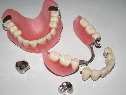 Некачественное протезирование зубов