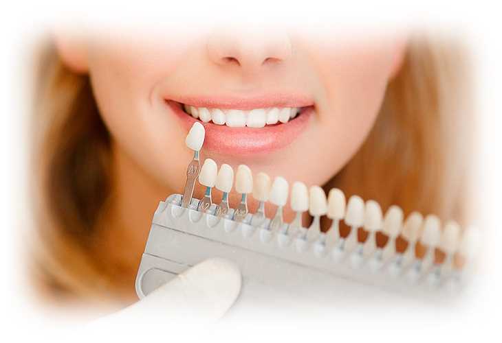 Разновидности восстановления формы зубов