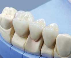 Ортопедическое протезирование зубов — эффективный и безопасный способ восстановления зубного ряда