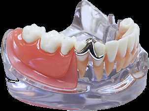 Особенности протезирования зубов