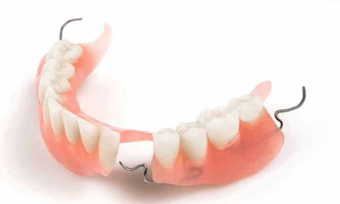 Полные съемные зубные протезы к клиниках «ОЛЬГА»